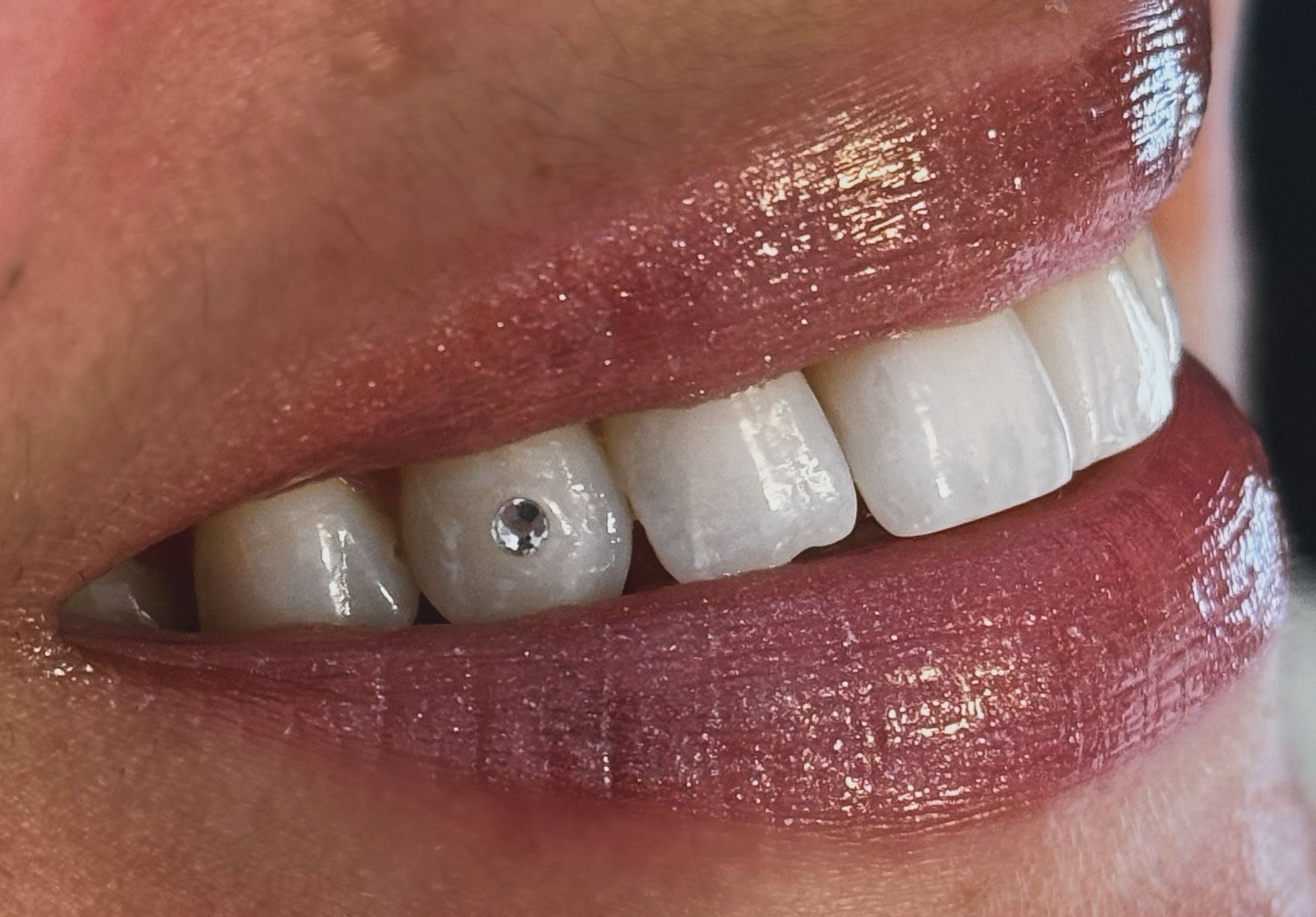 Eén toothgem in een glimlach